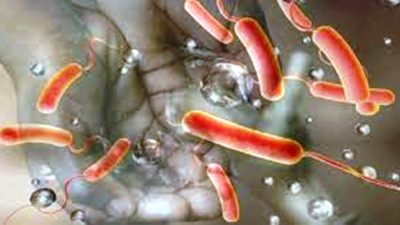 चार जनामा हैजा पुष्टि